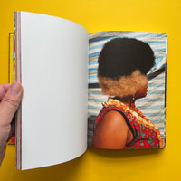 Lorenzo Vitturi: Dalston Anatomy (Signed)