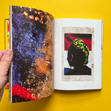 Lorenzo Vitturi: Dalston Anatomy (Signed)